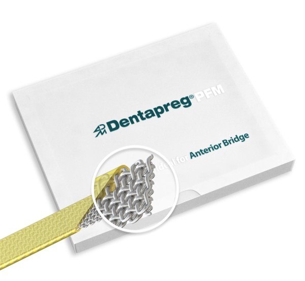 PFM_anterior-bridges_fiber-composites